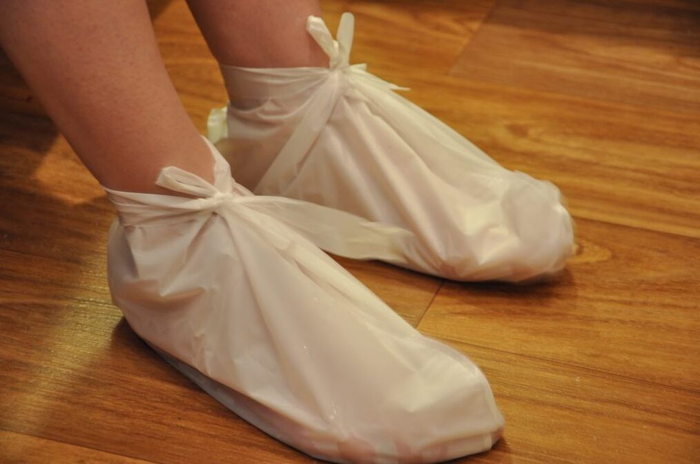 Kompressen gegen Knöchelarthrose