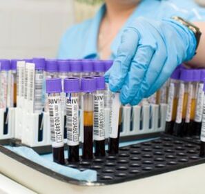 Bluttest zur Diagnose von Gelenkschmerzen